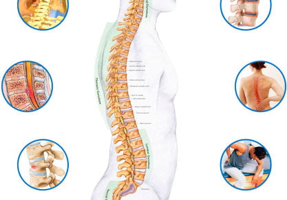 Радикулит — симптомы и лечение болезни
