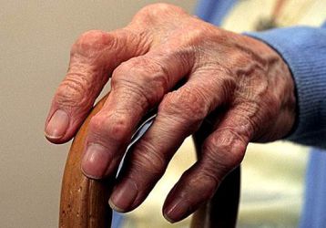 Реактивный полиартрит суставов: симптомы и лечение