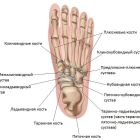 Таранно-ладьевидный сустав: причины артроза, признаки и лечение
