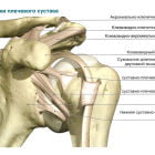 Разрыв связок плечевого сустава: симптомы, лечение и срок заживления