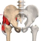 Что такое тендиноз тазобедренного сустава и как его лечить?