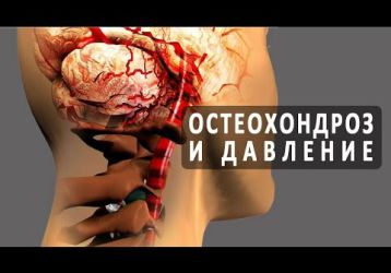 Шейный остеохондроз и артериальное давление: причины взаимосвязи Гипертонии