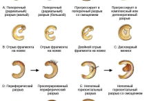 Разрыв мениска коленного сустава: причины травмы, симптомы, диагностика и методы лечения