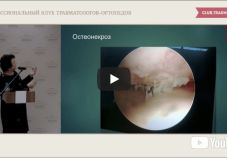 Видео: миниинвазивное лечение артрозов и артритов коленного сустава. Кузнецова В.П. (Воронеж, Россия)