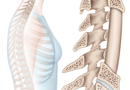 Дорсалгия: что такое и полная информация о лечении заболевания