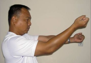 Контрактура локтевого сустава: причины, лечение и ЛФК после перелома