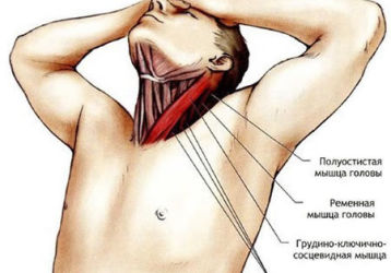 Как лечить растяжение мышц шеи: причины, симптомы и методы лечения