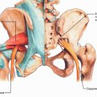 Защемление седалищного нерва: миогенное, дискогенное и вертеброгенное