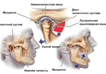 Артроз челюстного сустава: причины, симптомы и лечение