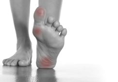Болит сустав большого пальца на ноге: чем лечить и как, причины появления боли