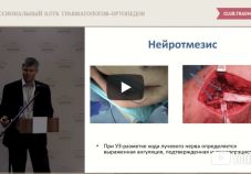 Видео: ревизия лучевого нерва при переломах плечевой кости. Боголюбский Ю.А. (Москва, Россия)