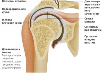 Лечение деформирующего артроза плечевого сустава