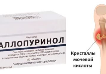 Как принимать Аллопуринол при подагре: показания, противопоказания, дозировка