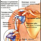 Остеоартроз плечевого сустава: симптомы и лечение хрящевой ткани
