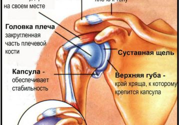 Остеоартроз плечевого сустава: симптомы и лечение хрящевой ткани
