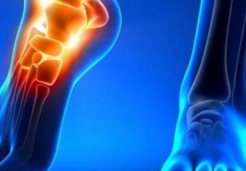 Тендовагинит голеностопного сустава: причины, диагностика и методы лечения