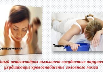 Почему появляется тошнота при остеохондрозе: причины и схемы лечения