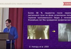 Видео: лечение и профилактика переломов шейки бедренной кости у лиц пожилого и старческого возраста