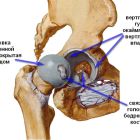 Основные болезни тазобедренного сустава: как установить и лечить