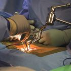 Качественная реабилитация после операции грыжи позвоночника