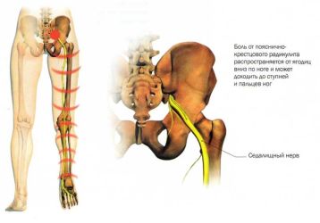 Самые эффективные уколы от радикулита: список популярных препаратов