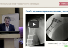 Видео: переломы проксимального отдела плечевой кости. А.А. Волна (Москва)