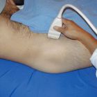 Что показывает УЗИ тазобедренного сустава: нормальные значения и отклонения