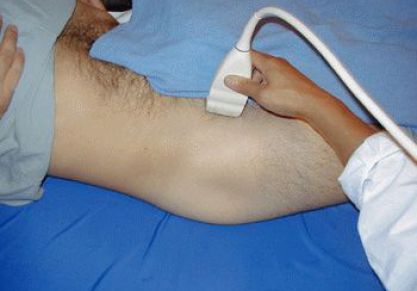 Что показывает УЗИ тазобедренного сустава: нормальные значения и отклонения