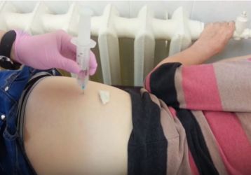 Что такое медикаментозная блокада тазобедренного сустава: показания, препараты, техника выполнения