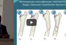 Видео: перипротезные переломы бедра. Современные подходы к лечению. Вишняков А.А. (Сургут)