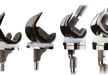 Эндопротезирование коленного сустава, цена операции