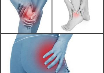 Артроз нижних конечностей — симптомы и лечение, причины заболевания