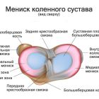 Менисцит коленного сустава: что такое, диагностика и лечение?