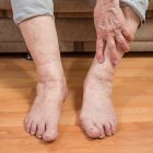 Лечение боли в суставах ног народными методами: рецепты и средства