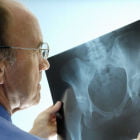 Рентгенография ТБС: особенности проведения, диагностические возможности и расшифровка