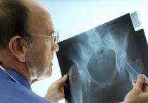 Что делать, если болят суставы — лечение, полное описание причин возникновения боли