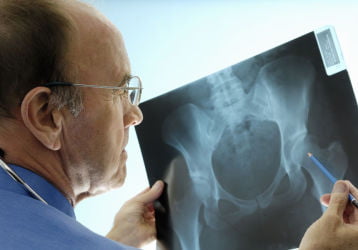 Рентгенография ТБС: особенности проведения, диагностические возможности и расшифровка