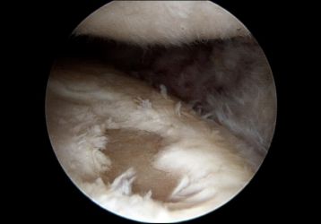 Народные методы лечения боли в коленных суставах: как не навредить себе