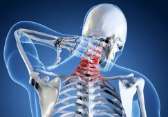 Протрузии и остеохондроз в шейном отделе