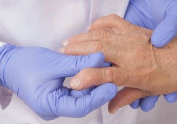 Ревматоидный артрит: симптомы, лечение, диагностика, стадии