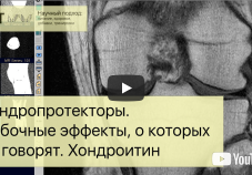 Видео исследование: побочные эффекты хондропротекторов о которых не говорят. Хондроитин и Глюкозамин.