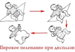 Основные техники пеленания при дисплазии тазобедренных суставов у новорожденных