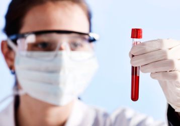 Ревматоидный фактор в крови — что это значит: повышенный, пониженный, норма