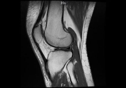 МРТ суставов