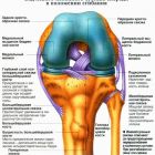 Что такое дегенеративные изменения менисков, почему они появляются и чем опасны?