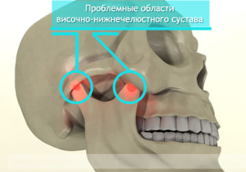 Основные причины появления боли в височно-нижнечелюстном суставе