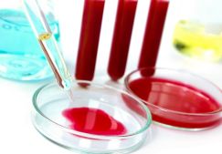 Какие анализы необходимы при артрите: виды и методы лабораторной диагностики