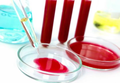 Какие анализы необходимы при артрите: виды и методы лабораторной диагностики