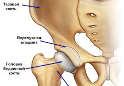Тазобедренный сустав