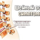 Почему хрустит шея?